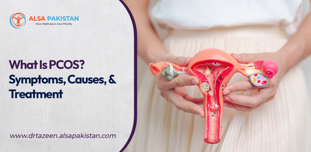 PCOS Treatment