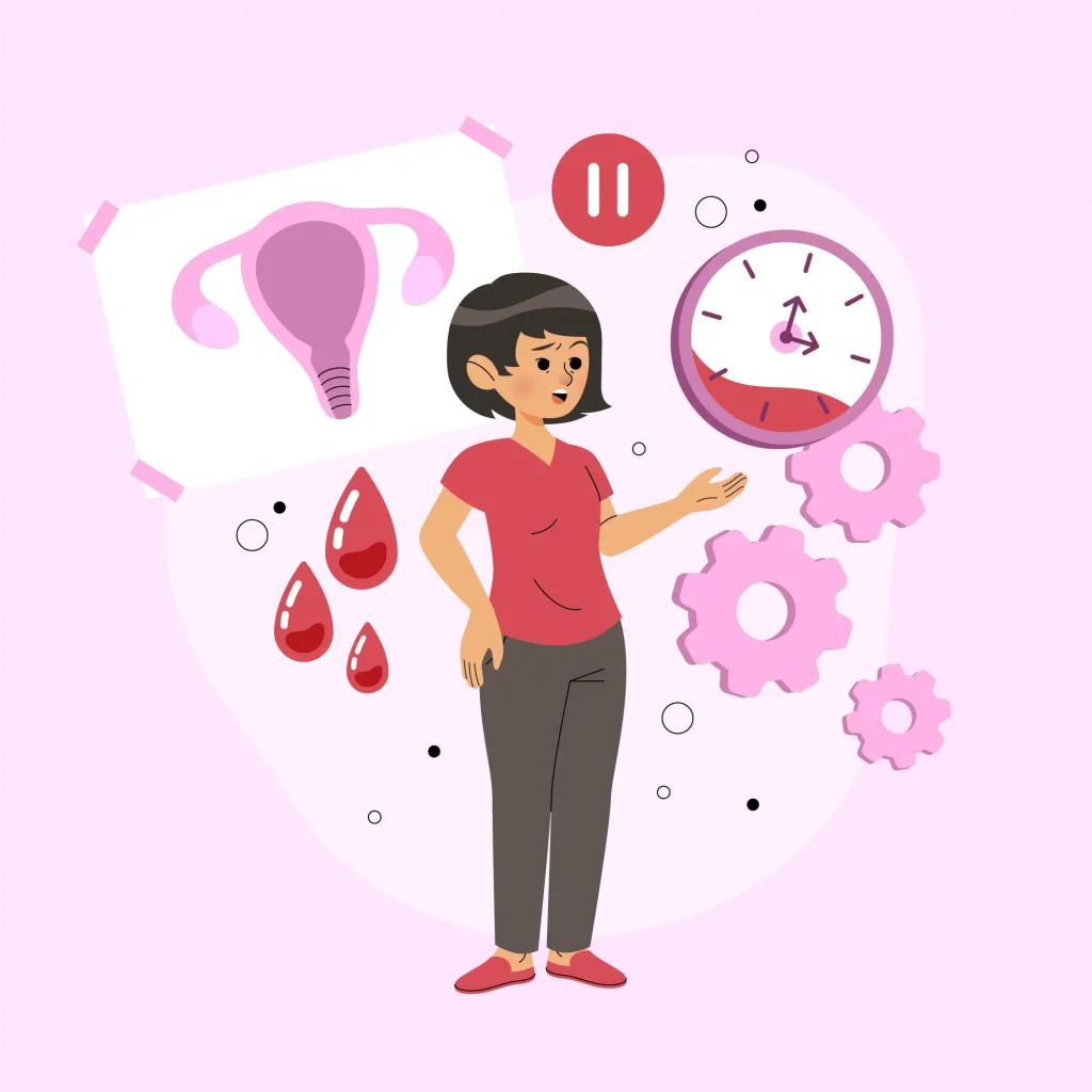 Irregular Periods in Women