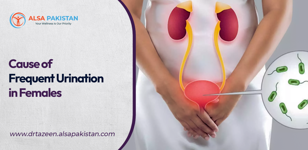 Causes of Frequent Urination In Females